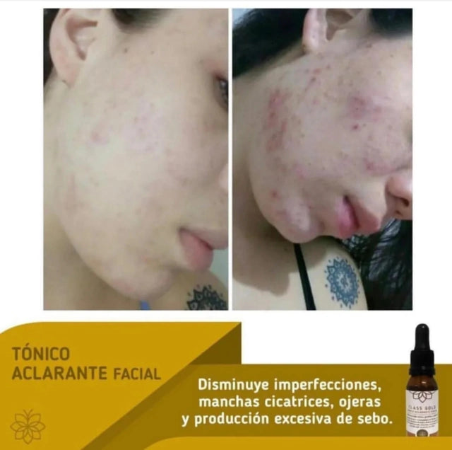 Tonico Aclarante Facial Class Gold 50 ml