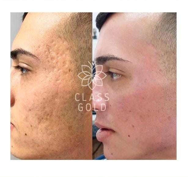 Tonico Aclarante Facial Class Gold 50 ml