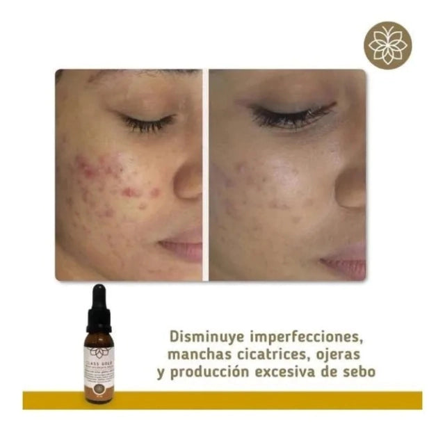 Tonico Aclarante Facial Class Gold 50 ml