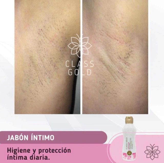 Jabon Intimo Inhibidor de Vellos Class Gold 120 ml