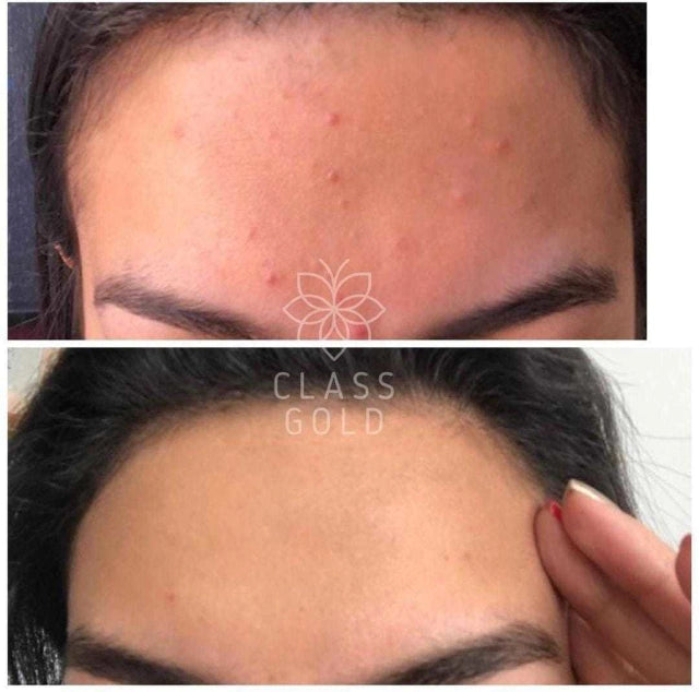 Jabon Facial Antioxidante piel mixta a seca Class Gold 32 grs