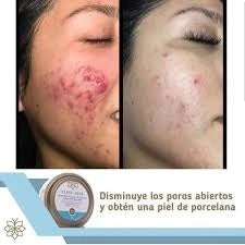 Mascarilla Facial de Arcilla Class Gold 150 grs