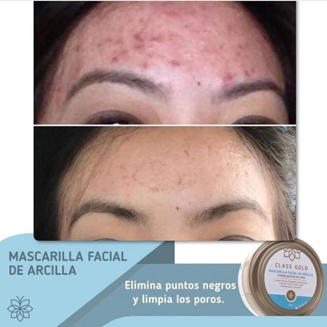 Mascarilla Facial de Arcilla Class Gold 150 grs