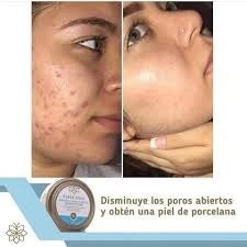 Mascarilla Facial de Arcilla Class Gold 150 grs