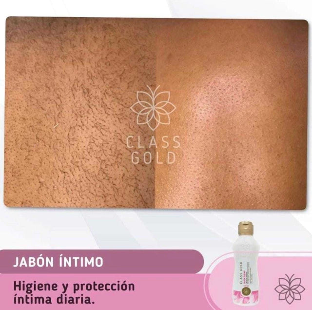 Jabon Intimo Inhibidor de Vellos Class Gold 120 ml