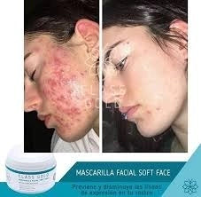 Mascarilla Facial Soft Face Class Gold 120 ml